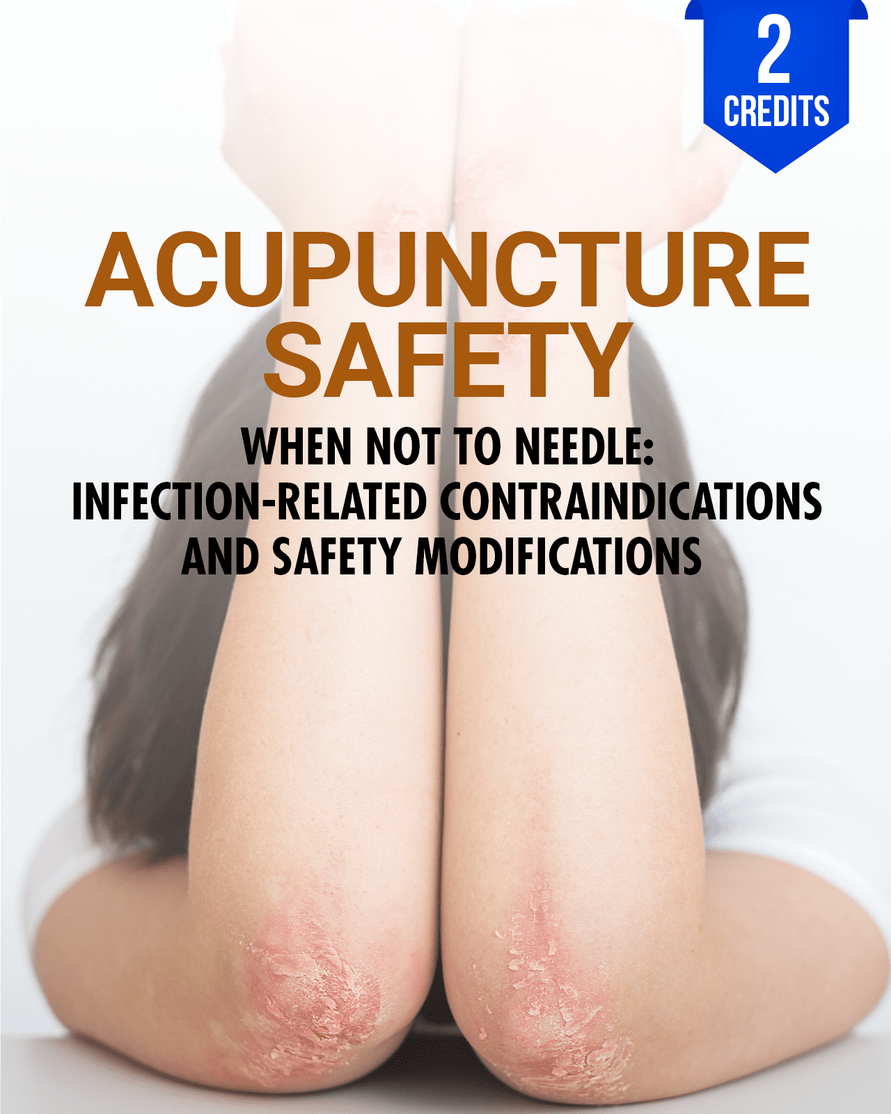 When Not to Needle: Acupuncture Infection-Related Contraindications and Safety Modifications - Chiropractic Continuing Education, Acupuncture, Safety, 2 Hours A Better Chiro